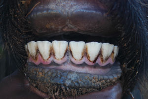 Red 67 - Teeth Condition
